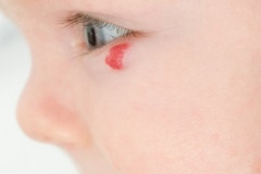 Clinical Photography